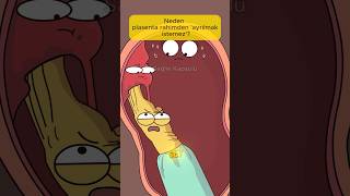 Neden Plasenta Rahimden Ayrılmak Istemez?