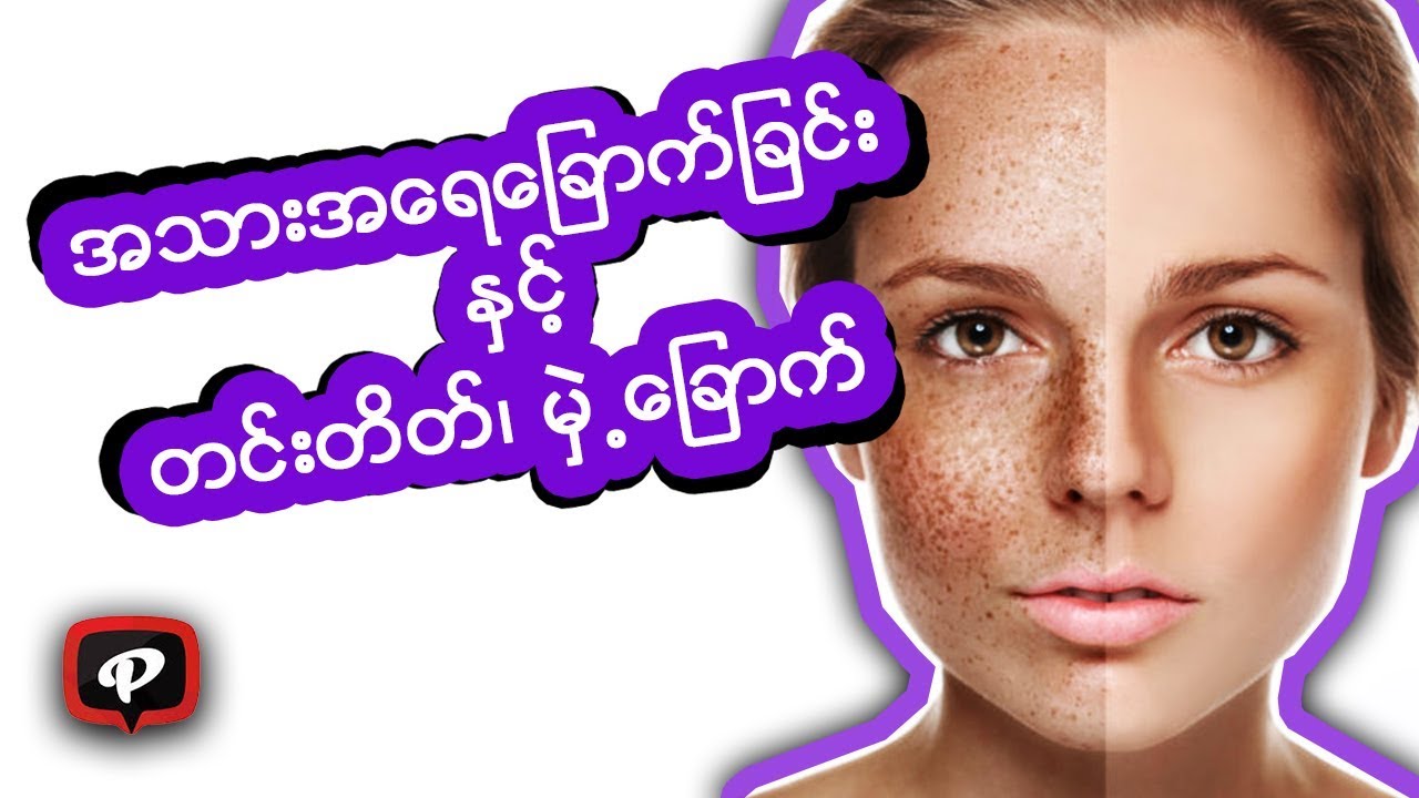 အသားအေရေျခာက္ျခင္းႏွင့္ တင္းတိတ္၊ မွဲ႕ေျခာက္