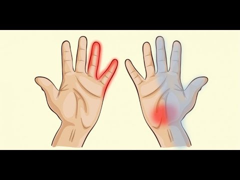 건강 당신 손이 일러 주는 건강 적신호 7개