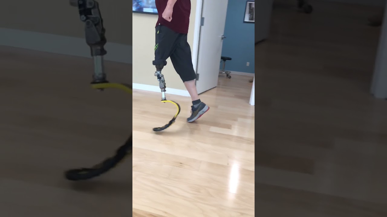 Running with an AK prosthetic