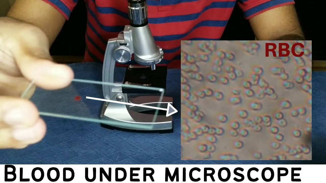 Taking a look at my blood under a microscope 1200x Similarities