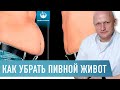 Пластика живота у мужчин. Абдоминопластика. Как убрать пивной живот за 1 день. Хирург Щевцов