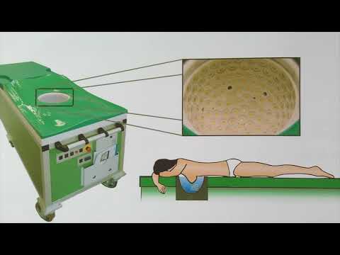 Video: Brust-MRT-Scan: Zweck, Verfahren Und Ergebnisse