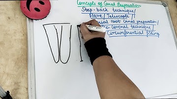 cleaning and shaping of root canal (step back technique)