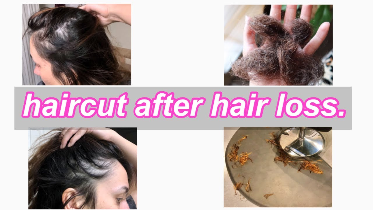 Hair Loss Haircut (Telogen Effluvium Recovery) YouTube
