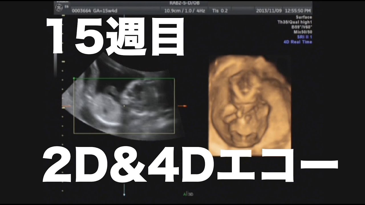 赤ちゃん 2d 4dエコー 15週目 鼻くそほじる Youtube