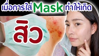 #130 เมื่อการใส่แมสทำให้เกิดสิว!!!!! | เภสัชท่องโลก 🌏