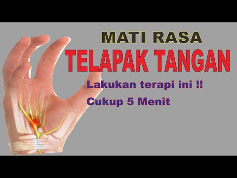 Cara mengatasi mati rasa { kebas } di telapak tangan