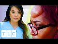 Woman's Bump TRIGGERS Severe Depression And Isolation | Dr Pimple Popper