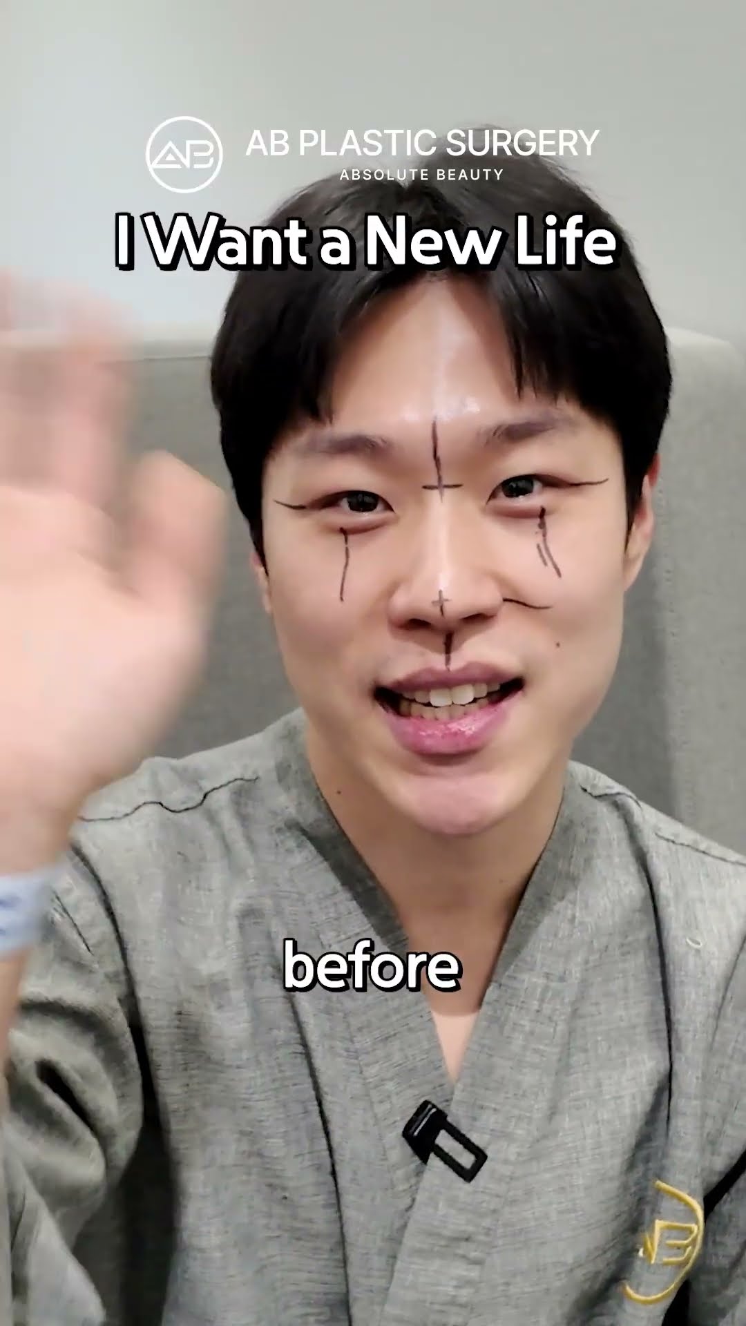 From Soft to Sharp | Eye & Nose Surgery Before & After #shorts