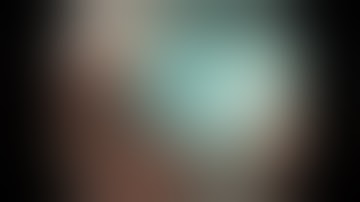 Colonoscopy: Ascending Colon EMR - large SSA