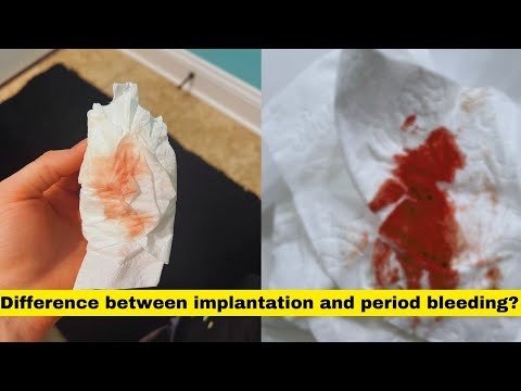 implantation bleeding vs periodimplantation bleeding or period