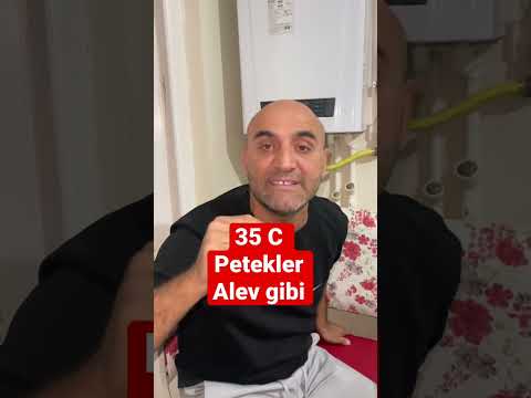 30 Derecede Petekler Neden Alev Gibi Olur?