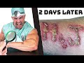 Burning my INITIALS into my Arm with a MAGNIFYING GLASS | Bodybuilder VS Crazy Burn Experiment