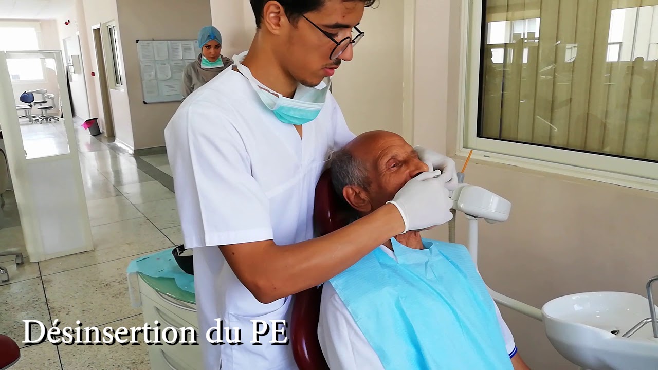 2 Empreintes primaires