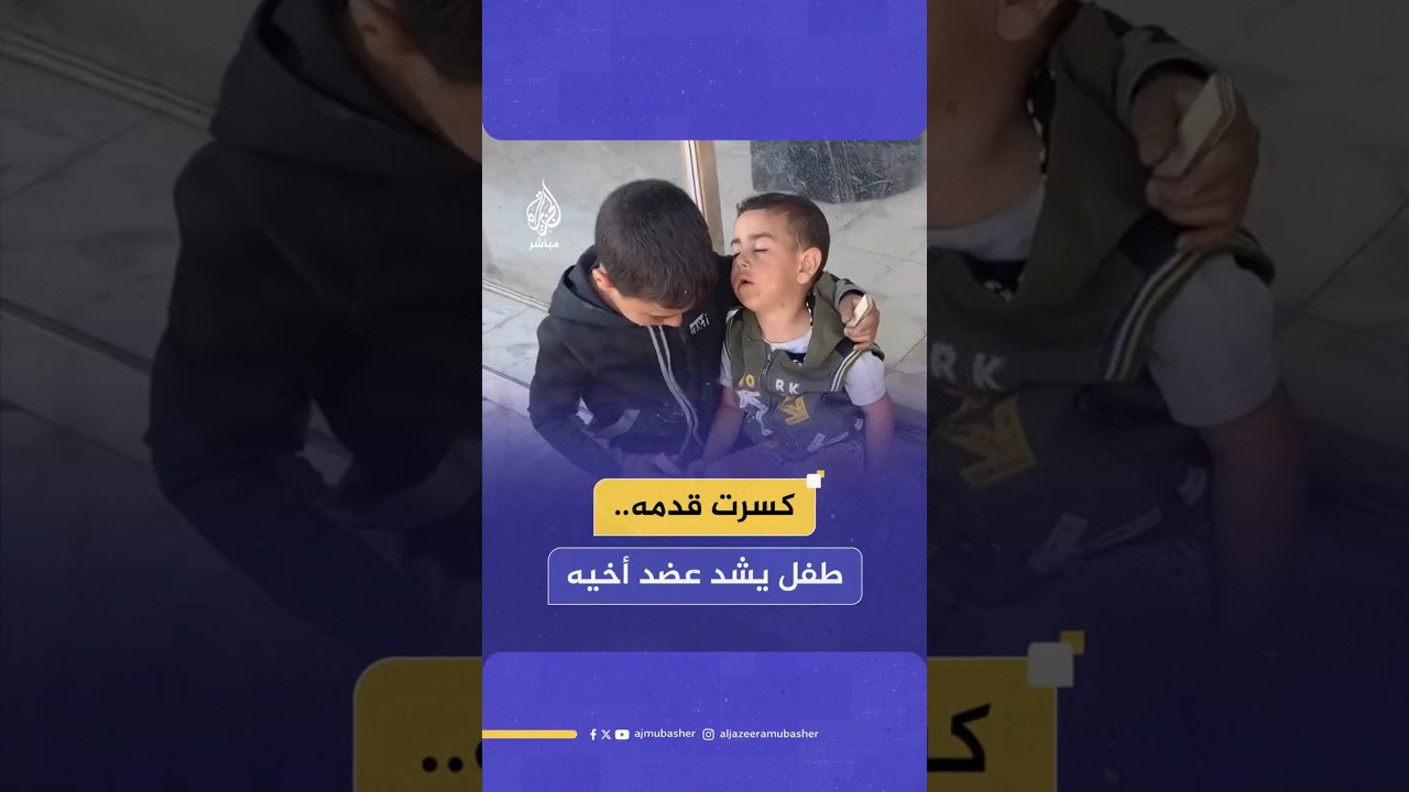 كسرت قدمه.. طفل يشد عضد أخيه