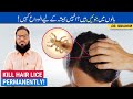 Juainlikhon khatam karne ka tarika  treat head hair lice  joen ka khatma  urduhindi