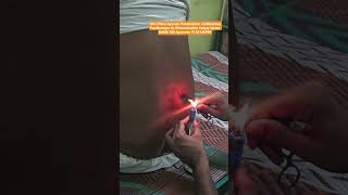 Dr.Bhimashankar Upase Mob 9130146999 #agnikarma #painrelief #backpain #sciatica #ayurved