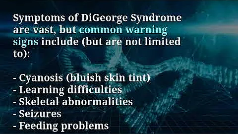 An Overview of DiGeorge Syndrome