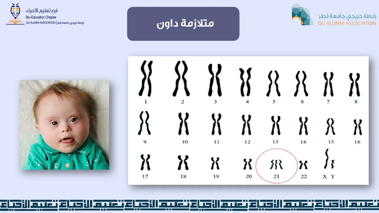 الكروموسومات