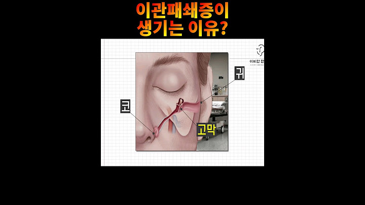 침을삼켜도 귀가 먹먹하다면 클릭!