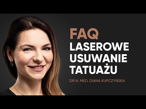 Laserowe usuwanie tatuażu – najczęstsze pytania