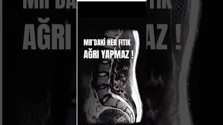 Mr Ağrinin Sebebi̇ni̇ Söylemez