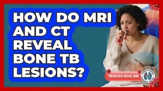 How Do MRI And CT Reveal Bone TB Lesions? - Tuberculosis Disease Guide screenshot 3