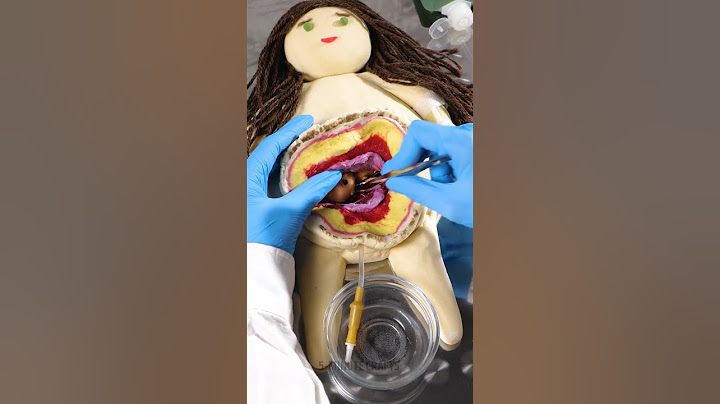How This Surgery Really Works 👨‍⚕️🔬