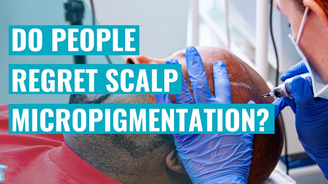 Navigating Scalp Micropigmentation Regrets: Expert Advice