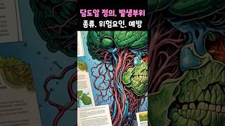 담도암의 정의, 종류, 발생부위, 위험요인 및 예방법