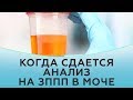 Когда сдается анализ на ЗППП в моче