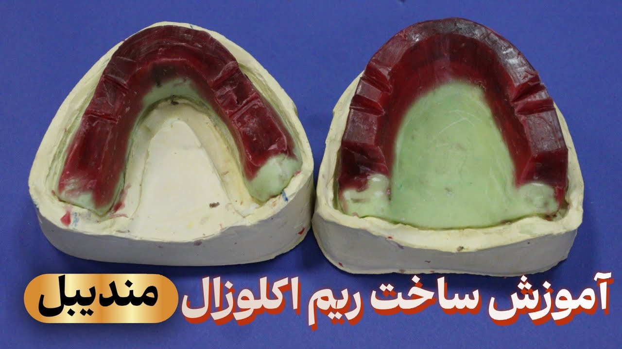 پروتز کامل - ساخت ریم اکلوزال (بخش سوم) | ریم مندیبل