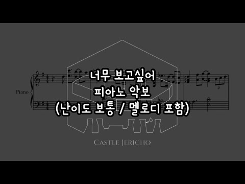 너무 보고싶어 - 어쿠스틱 콜라보