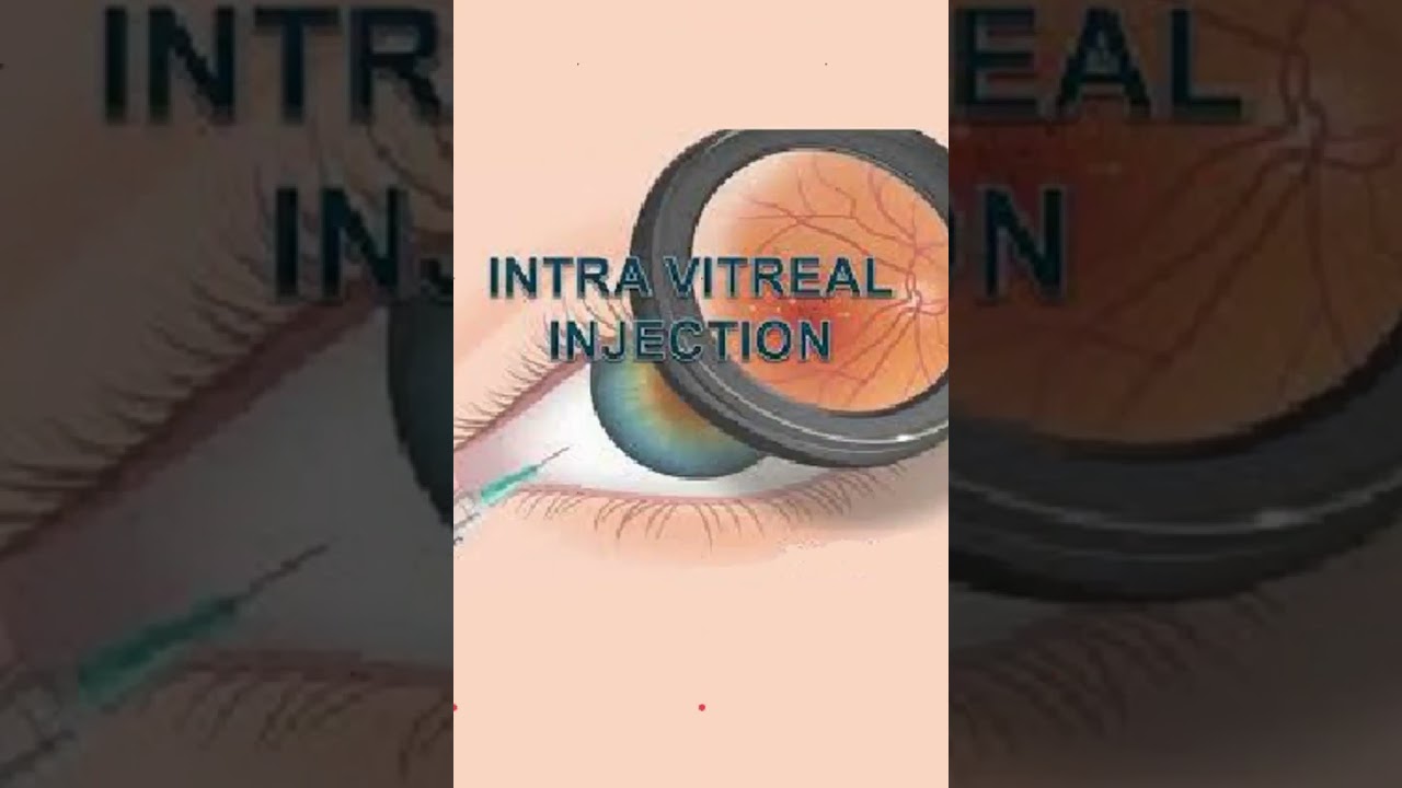 Treatment of Diabetic Retinopathy #shorts