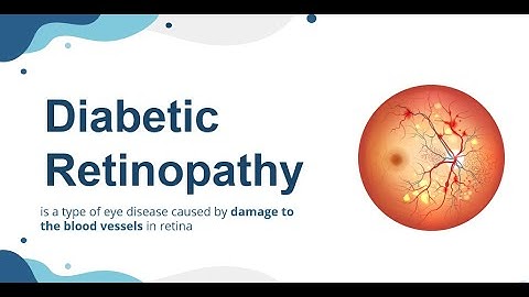 Explainable AI (LRP) for Medical Image Classification