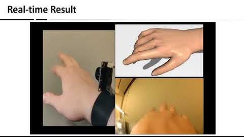 Back-Hand-Pose: 3D Hand Pose Estimation for a Wrist-worn Camera via Dorsum Deformation Network