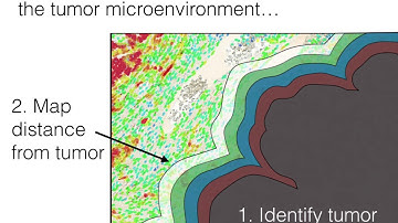 ImageDx  - Understanding the Tumor Microenvironment