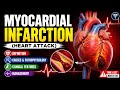 MYOCARDIAL INFRACTION (MI)/heart attack part-1