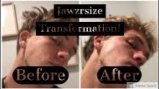 I TRIED JAWZRSIZE FOR 30 DAYS! Here's what happened...