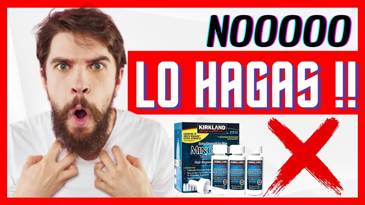 ✅ GUÍA COMPLETA DEL MINOXIDIL EN LA BARBA 👨🏻‍⚕️ Errores que NO debes cometer al usar MINOXIDIL