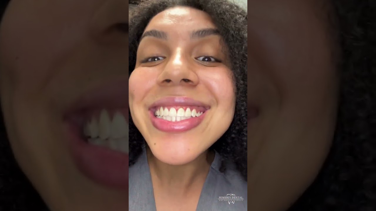 Gingivectomy - A simple way to even out your smile