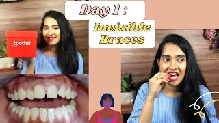 My Invisible Aligner: Day 1 | Unboxing of Aligner | Invisible Braces Precautions in India  | Toothsi