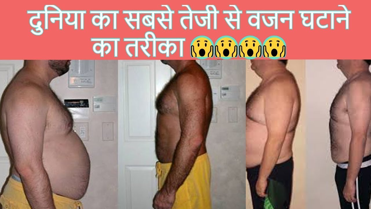 Fastest Way To Loss Weight वजन घटाने का तेज तरीका Bariatric / Weight