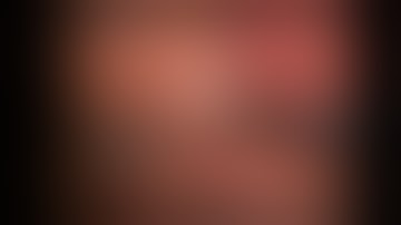 Laparoscopic one hour+ total D2-gastrectomy