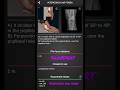 Intercondyle fossa view postioning #anatomy #medicalimaging #medical #xray #radiology #cardiology