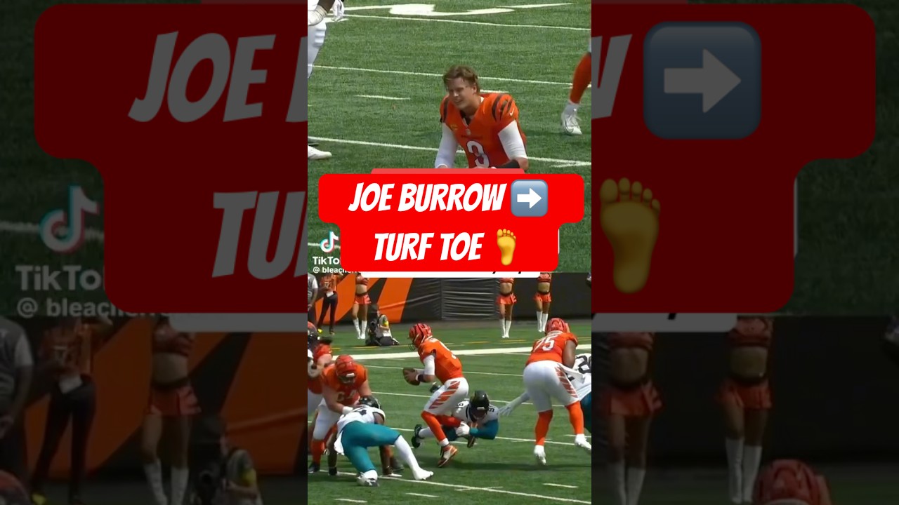 Joe Burrow’s Turf Toe Explained 🏈 | How Serious Is This Injury?