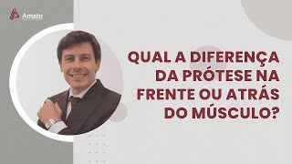 Qual a Diferença da Prótese na Frente ou Atrás do Músculo? Qual a Diferença da Prótese na Frente ou Atrás do Músculo?
