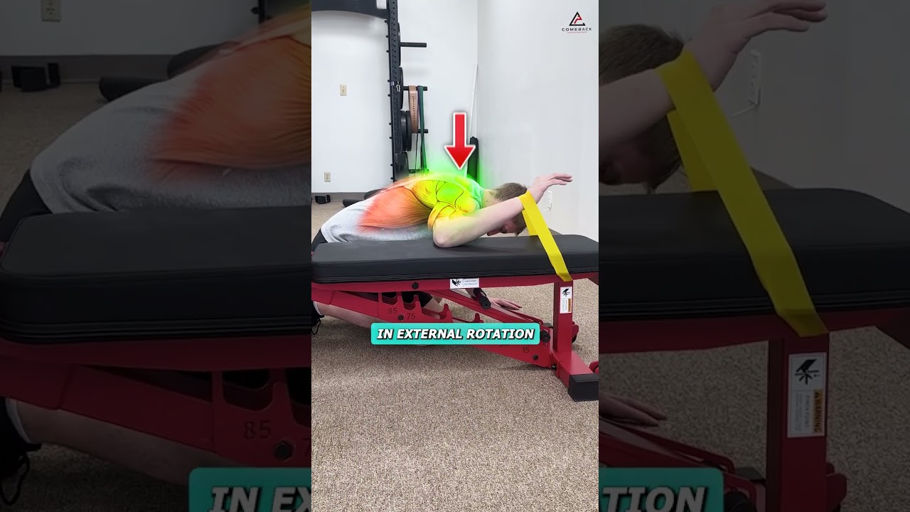 🎯 Fix Your Rotator Cuff Tear (For Good)