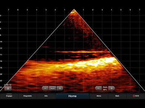 high reso forward retrieve video preview
